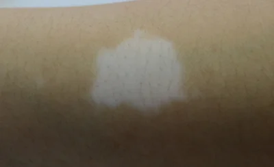 arm-1
