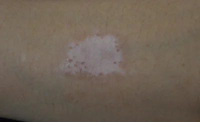 arm-2