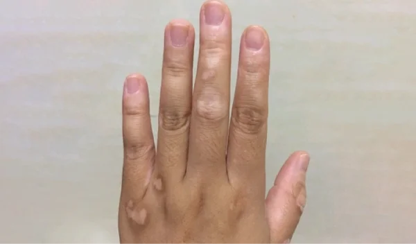 fingers-1