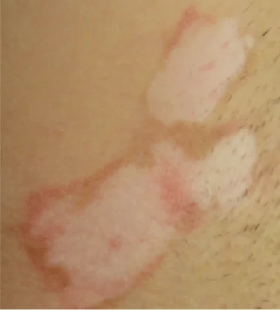 underarm-1